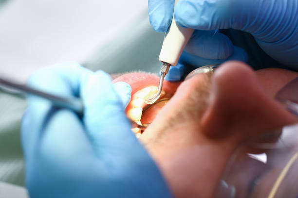 Best Emergency Treatment for Toothache in Dublin, CA