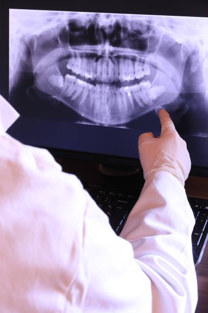 Best Emergency Wisdom Teeth Removal in Dublin, CA